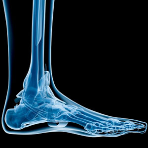 Foot x-ray