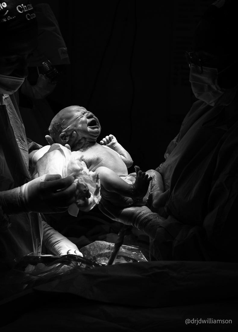 Surgeon or Midwife holding a child just after birth