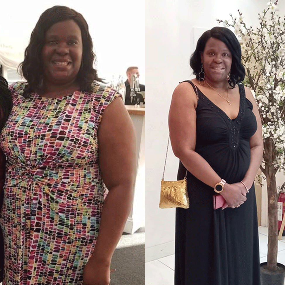Julie before and after taking part in the NHS Type 2 Diabetes Path to Remission Programme
